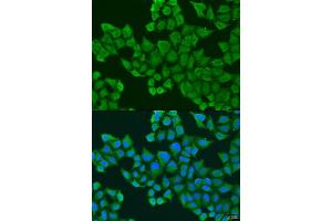 Image no. 1 for anti-UL16 Binding Protein 2 (ULBP2) antibody (ABIN6293785)