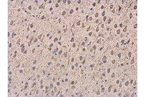 IHC-P Image DCTN1 antibody [C3], C-term detects DCTN1 protein at cytoplasm in Rat brain by immunohistochemical analysis.