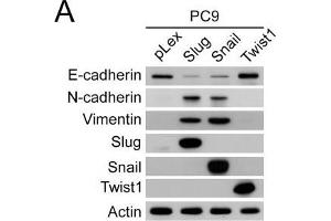 Snail- and Slug-induced EMT promoted drug resistance of parental PC9 and HCC827 cells.