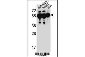 Western Blotting (WB) image for anti-Ankyrin Repeat Domain 57 (ANKRD57) (C-Term) antibody (ABIN2159123)