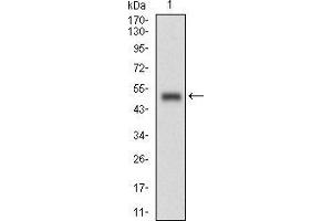 anti-Ran GTPase Activating Protein 1 (RANGAP1) (AA 359-587) antibody