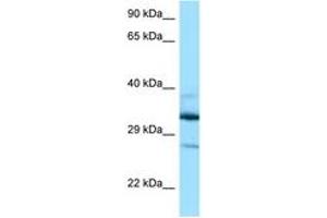 anti-Deoxyhypusine Hydroxylase/monooxygenase (DOHH) (AA 63-112) antibody