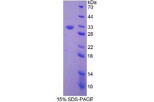Image no. 1 for Filamin B, beta (FLNB) (AA 1-237) protein (His tag,T7 tag) (ABIN1981175)
