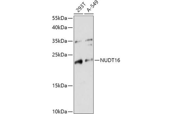 NUDT16 抗体  (AA 60-130)