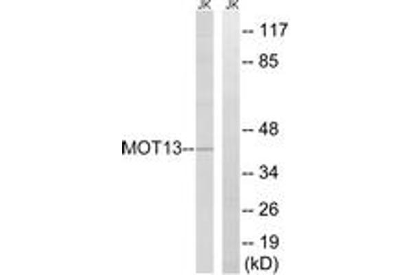 anti-Solute Carrier Family 16, Member 13 (Monocarboxylic Acid Transporter 13) (SLC16A13) (AA 377-426) antibody