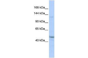 anti-KIAA0319L (KIAA0319L) (Middle Region) antibody