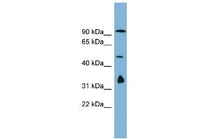 Image no. 1 for anti-MAK10 Homolog, Amino-Acid N-Acetyltransferase Subunit (MAK10) (N-Term) antibody (ABIN2782587)