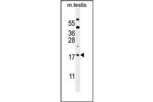 Image no. 1 for anti-ORM1-Like 3 (ORMDL3) (AA 56-85), (Middle Region) antibody (ABIN953939)