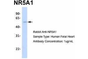Image no. 3 for anti-Nuclear Receptor Subfamily 5, Group A, Member 1 (NR5A1) (Middle Region) antibody (ABIN2777447)