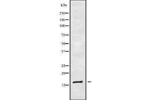 Image no. 1 for anti-Trafficking Protein Particle Complex 1 (TRAPPC1) antibody (ABIN6265715)