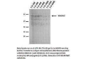 Image no. 2 for anti-Proteasome (Prosome, Macropain) 26S Subunit, Non-ATPase, 14 (PSMD14) antibody (ABIN108606)