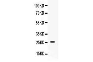 Image no. 3 for anti-Apolipoprotein A-I (APOA1) (AA 25-267) antibody (ABIN4886466)