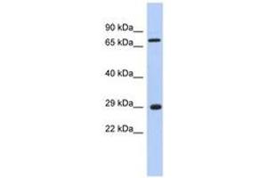 Image no. 1 for anti-AKT Interacting Protein (AKTIP) (C-Term) antibody (ABIN6744004)