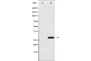 anti-14-3-3 zeta (YWHAZ) (pSer58) antibody