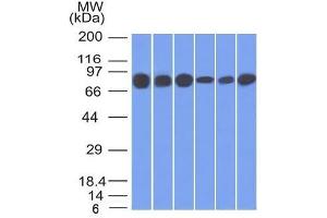 Image no. 1 for anti-Junction Plakoglobin (JUP) antibody (ABIN6939839)