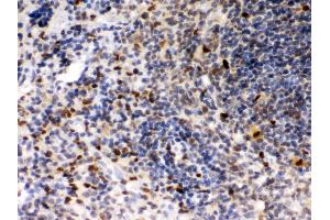 Image no. 3 for anti-Spleen Focus Forming Virus (SFFV) Proviral Integration Oncogene Spi1 (SPI1) (AA 18-196) antibody (ABIN3043440)