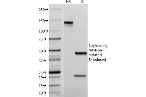 Image no. 1 for anti-Tumor-Associated Calcium Signal Transducer 2 (TACSTD2) (AA 31-274) antibody (ABIN6939972)
