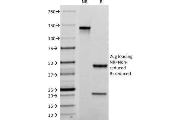 anti-Tumor-Associated Calcium Signal Transducer 2 (TACSTD2) (AA 31-274) antibody