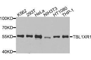 Image no. 1 for anti-Transducin (Beta)-Like 1 X-Linked Receptor 1 (TBL1XR1) antibody (ABIN4905376)