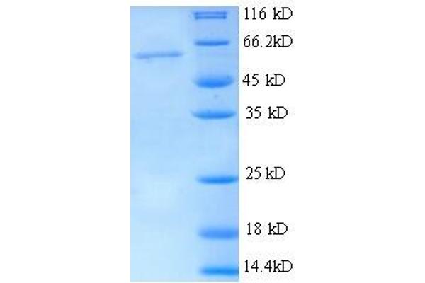 THBS3 Protein (AA 24-350, partial) (His tag)