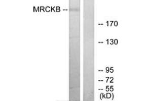 Image no. 2 for anti-CDC42 Binding Protein Kinase beta (DMPK-Like) (CDC42BPB) (AA 1641-1690) antibody (ABIN1534220)
