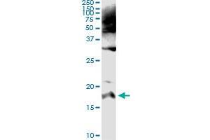 Image no. 5 for anti-serine Peptidase Inhibitor, Kazal Type 1 (SPINK1) (AA 24-79) antibody (ABIN562978)