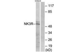 Image no. 1 for anti-Tachykinin Receptor 3 (TACR3) (AA 401-450) antibody (ABIN1535785)