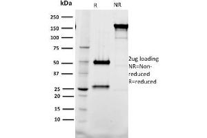 Image no. 1 for anti-T-Cell Acute Lymphocytic Leukemia 1 (TAL1) antibody (ABIN6940681)