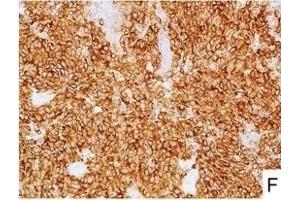 Image no. 9 for anti-L1 Cell Adhesion Molecule (L1CAM) (AA 1-1120) antibody (ABIN1995799)