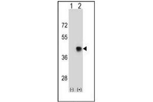 anti-Spermatid Maturation 1 (SPEM1) (AA 114-144), (Middle Region) antibody
