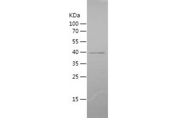 PKC zeta Protein (AA 454-592) (His-IF2DI Tag)