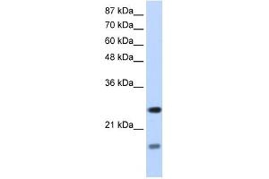 Image no. 2 for anti-Signal Recognition Particle 14kDa (Homologous Alu RNA Binding Protein) (SRP14) antibody (ABIN629979)