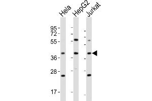 OR5M9 anticorps  (C-Term)
