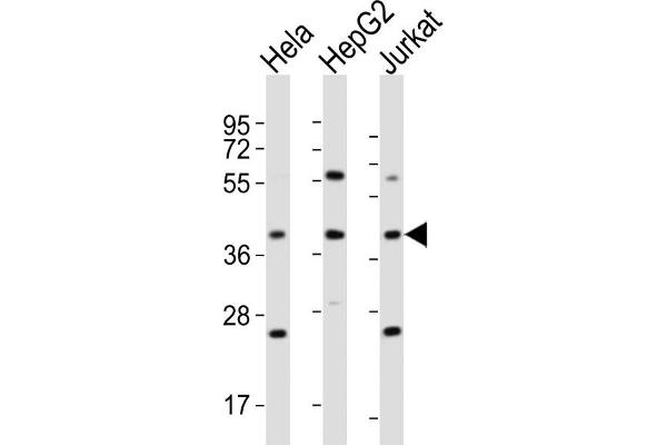 OR5M9 anticorps  (C-Term)