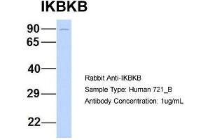 Image no. 2 for anti-Inhibitor of kappa Light Polypeptide Gene Enhancer in B-Cells, Kinase beta (IKBKB) (N-Term) antibody (ABIN2779787)