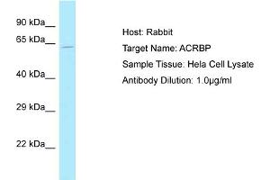 Image no. 1 for anti-Acrosin Binding Protein (ACRBP) (N-Term) antibody (ABIN2787748)