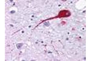 NMUR2 anticorps  (Cytoplasmic Domain)