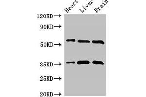 STK35 抗体  (AA 1-200)