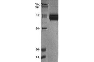Image no. 1 for delta-Like 1 Homolog (Drosophila) (DLK1) protein (ABIN2719523)