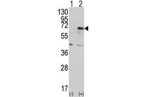 Image no. 3 for anti-Eukaryotic Translation Initiation Factor 2-alpha Kinase 2 (EIF2AK2) (AA 519-550) antibody (ABIN3030885)