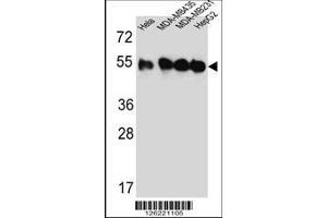 Image no. 1 for anti-Tubulin, beta 2C (TUBB2C) (AA 99-125) antibody (ABIN651319)