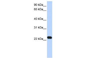 Image no. 1 for anti-Hepatitis B Virus X-Interacting Protein (HBXIP) (N-Term) antibody (ABIN2784809)