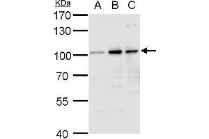 WB Image Aconitase 1 antibody detects Aconitase 1 protein by western blot analysis.