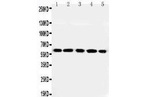 Image no. 1 for anti-Regulator of G-Protein Signaling 14 (RGS14) (AA 359-372), (C-Term) antibody (ABIN3042860)