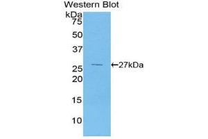 Western Blotting (WB) image for anti-Pyruvate Dehydrogenase Kinase 1 (PDK1) (AA 233-430) antibody (ABIN1860171)