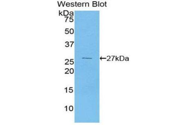 PDK1 Antikörper  (AA 233-430)