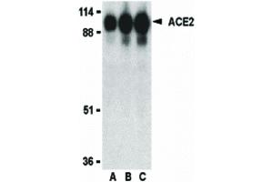 Image no. 1 for anti-Angiotensin I Converting Enzyme 2 (ACE2) (Internal Region) antibody (ABIN6655906)