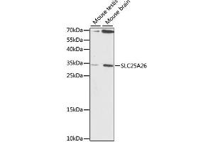 Image no. 1 for anti-Solute Carrier Family 25 (S-Adenosylmethionine Carrier), Member 26 (SLC25A26) antibody (ABIN6568753)