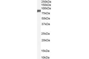 Image no. 1 for anti-delta Like Protein 3 (DLL3) (C-Term) antibody (ABIN2782904)