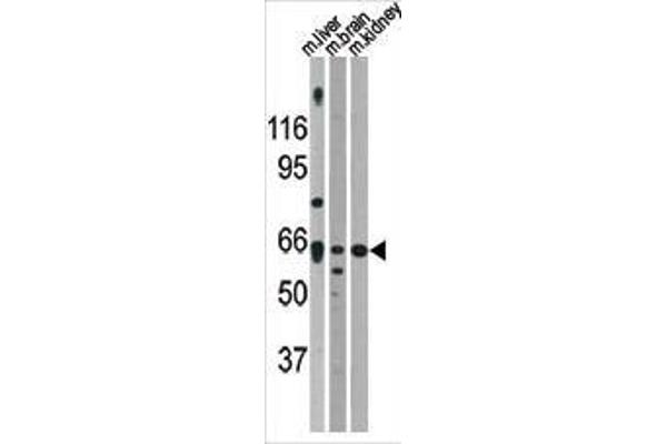 anti-Activin A Receptor, Type IIA (ACVR2A) (AA 2-29), (N-Term) antibody